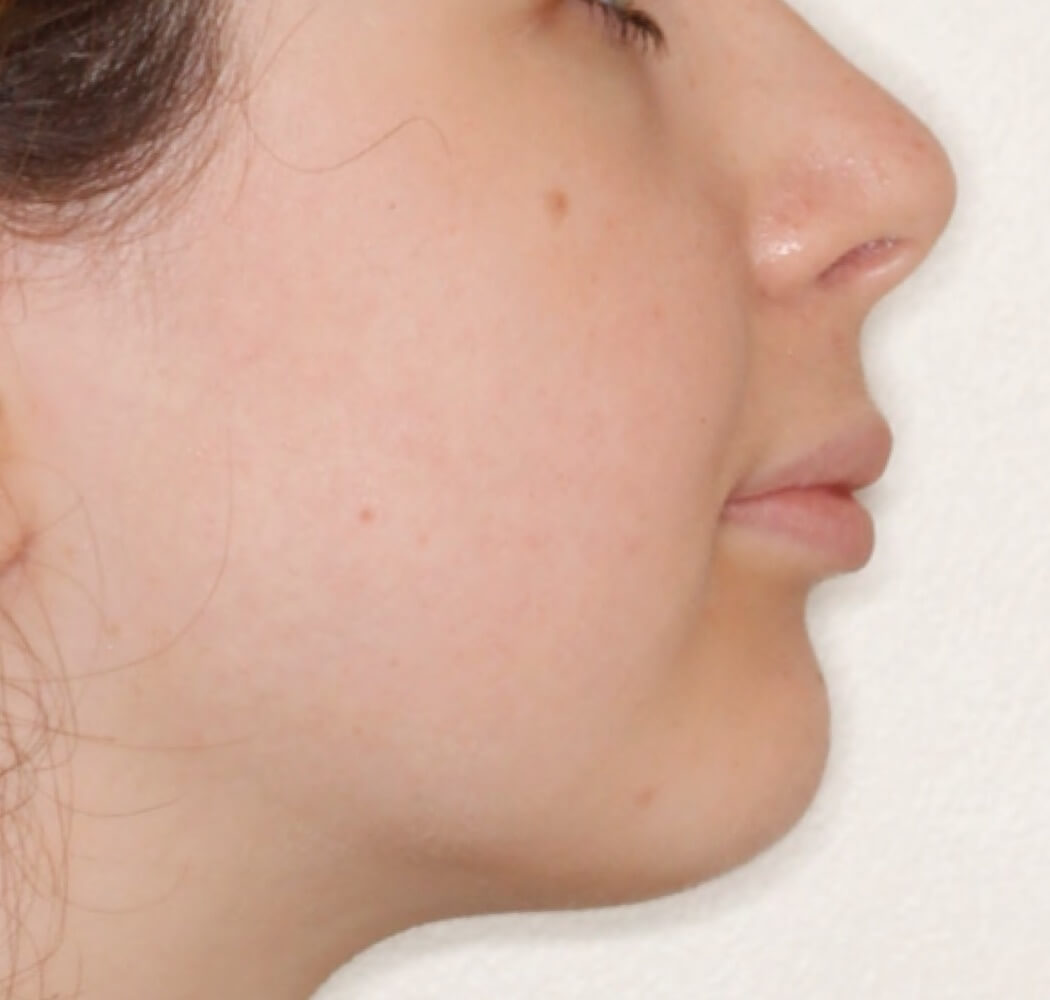 deepbites10 deepbites10