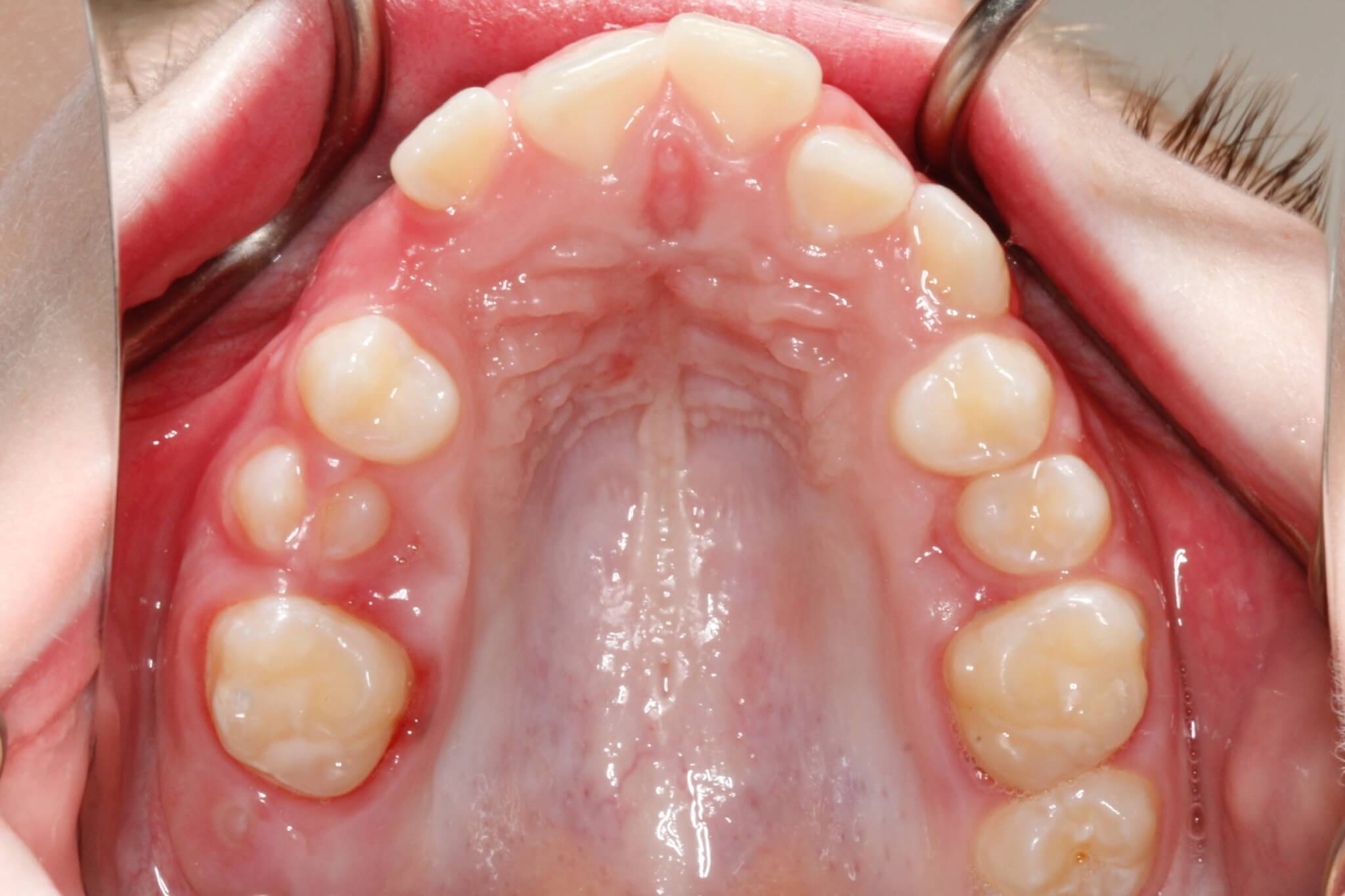 deepbites2 deepbites2