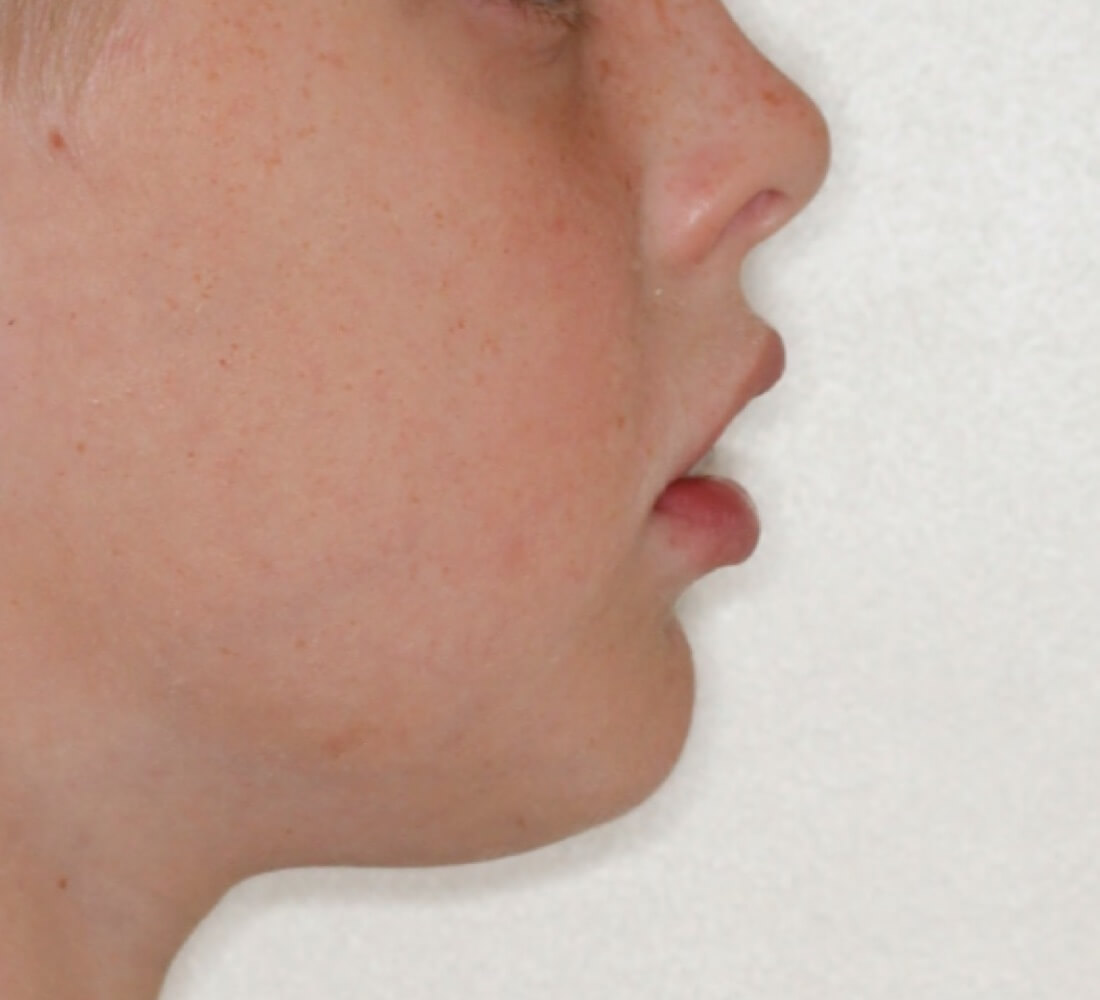 deepbites3 deepbites3