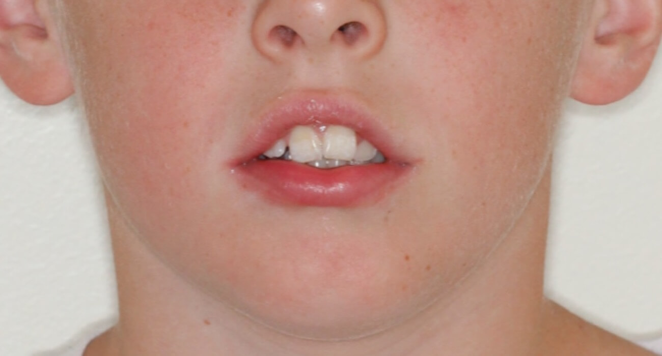 deepbites4 deepbites4