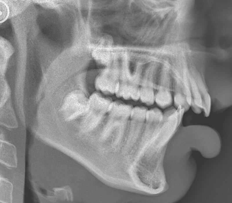 deepbites6 deepbites6