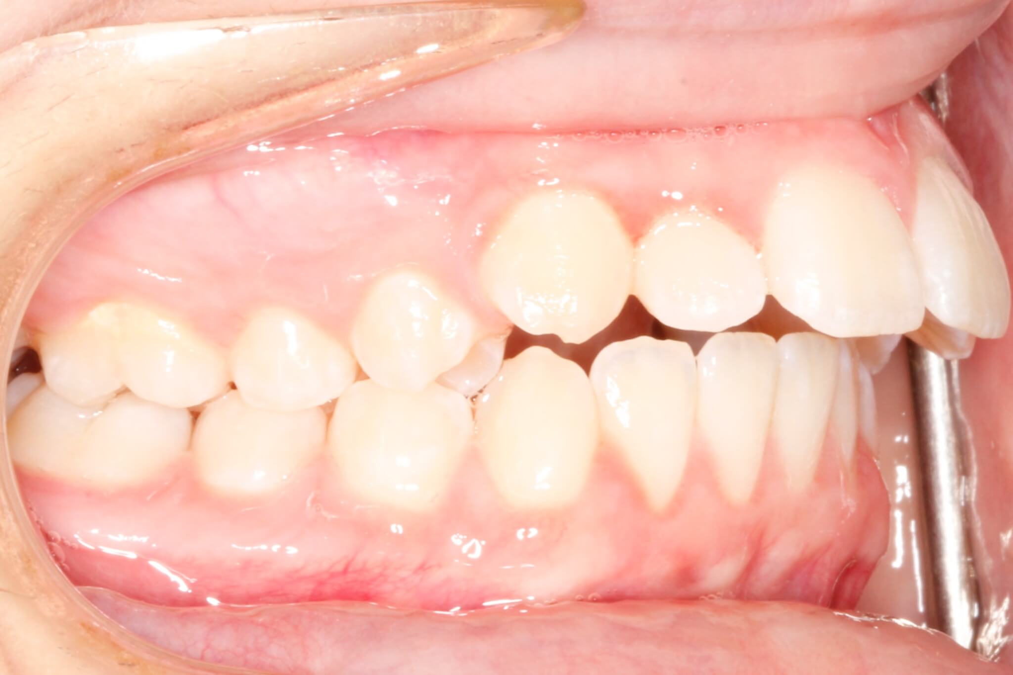 deepbites8 deepbites8