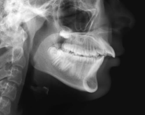 deepbites9 deepbites9