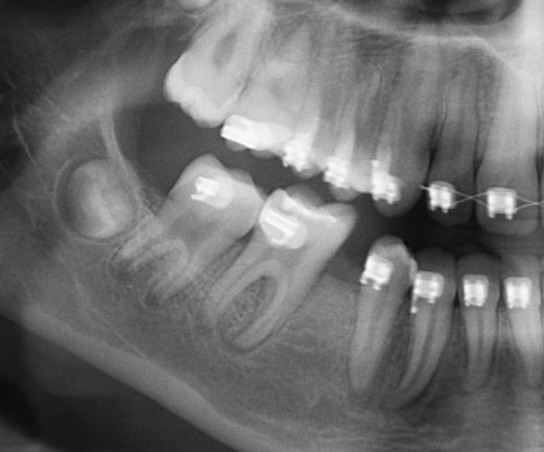 space-closure-bc1-before space-closure-bc1-before